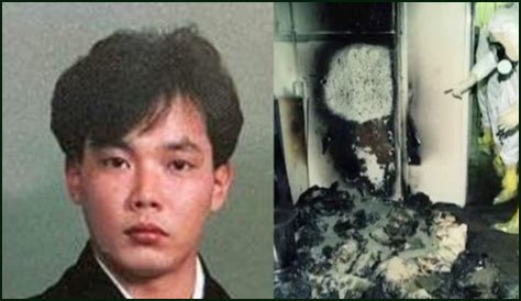 The Devastating Aftermath: Hisashi Ouchi's Autopsy Reveals Extent Of Radiation Damage